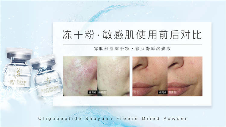 寡肽舒原滋养套盒
